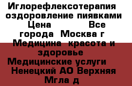 Иглорефлексотерапия, оздоровление пиявками › Цена ­ 3 000 - Все города, Москва г. Медицина, красота и здоровье » Медицинские услуги   . Ненецкий АО,Верхняя Мгла д.